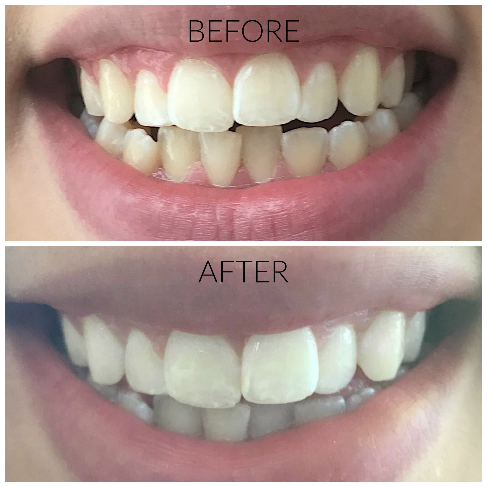 Graciela My Teeth Whitening Routine with Smile Brilliant + Giveaway