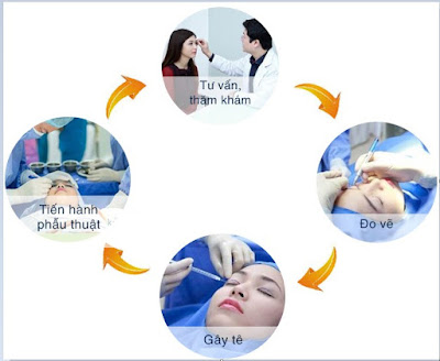 Quy trình cắt mí mắt được thực hiện tại Bệnh viện thẩm mỹ Kim