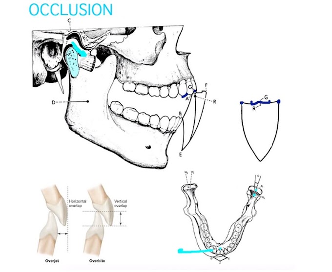 WEBINAR: Occlusion - Part 2