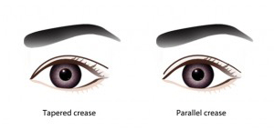 double eyelid procedure DST ME Aesthetic Clinic KL Malaysia Review