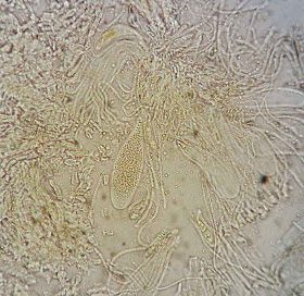 Sarea resinae ascus holds numerous ascospores