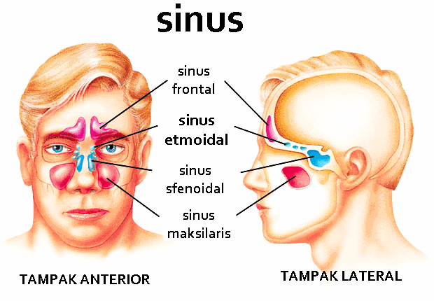 penyakit sinusitis