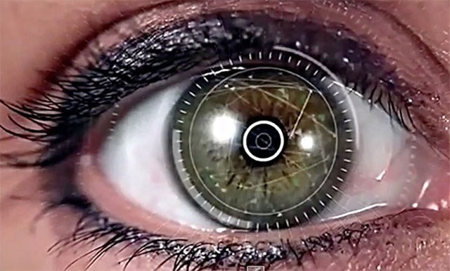 retina scan cost retina scan cost