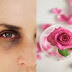 Remove Dark Circle with Help of Rose Water ( Home Remedies for Dark circle )