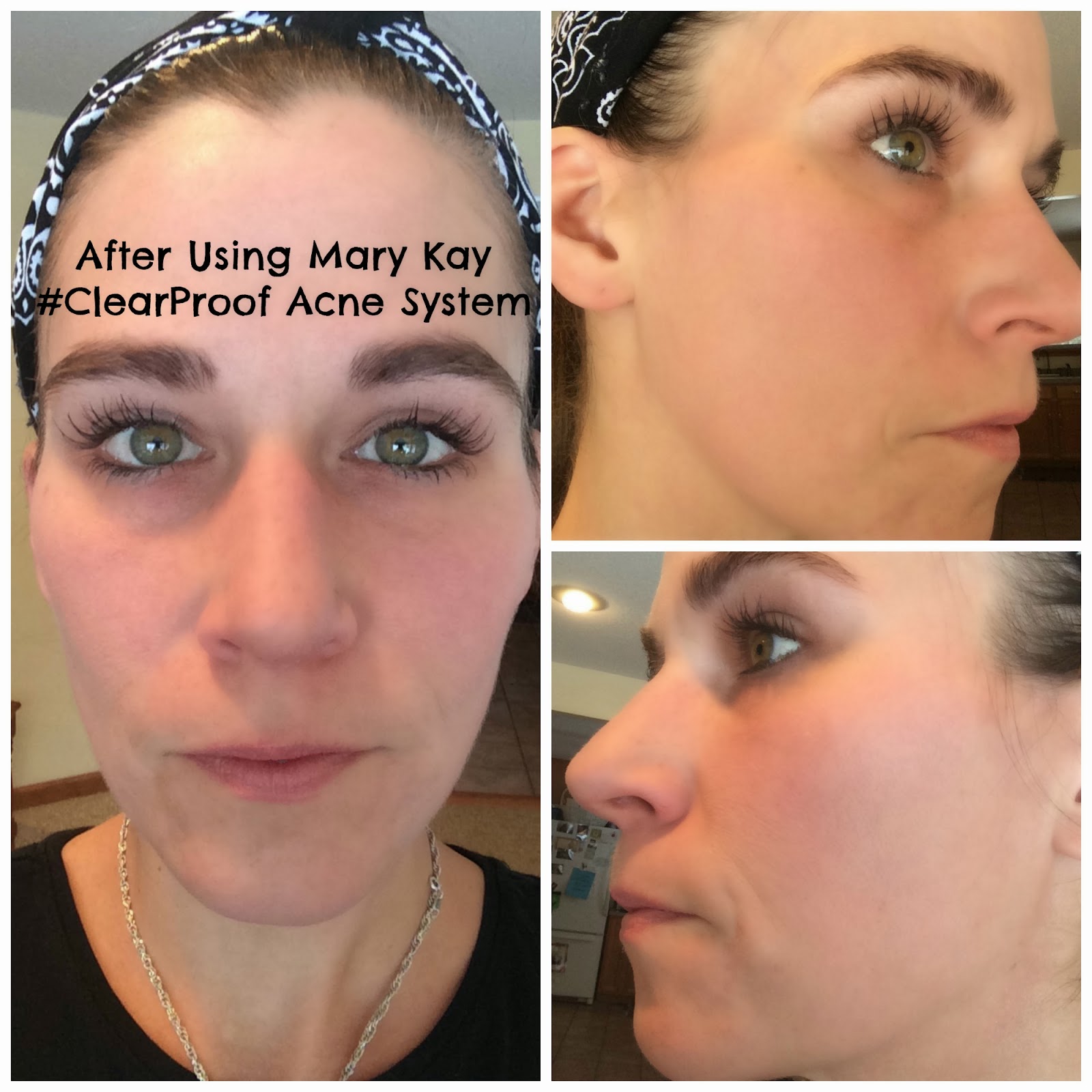 Mary Kay Clear Proof Acne System Review #ClearProof: A Little Goes A ...
