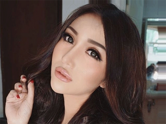 Lucinta Luna Sebelum Operasi Plastik