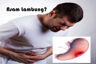 Ciri-Ciri Asam Lambung yang Hampir Mirip Gejala Liver Ciri-Ciri Asam Lambung yang Hampir Mirip Gejala Liver
