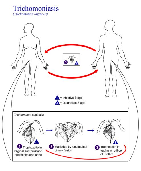 It is spread through sex