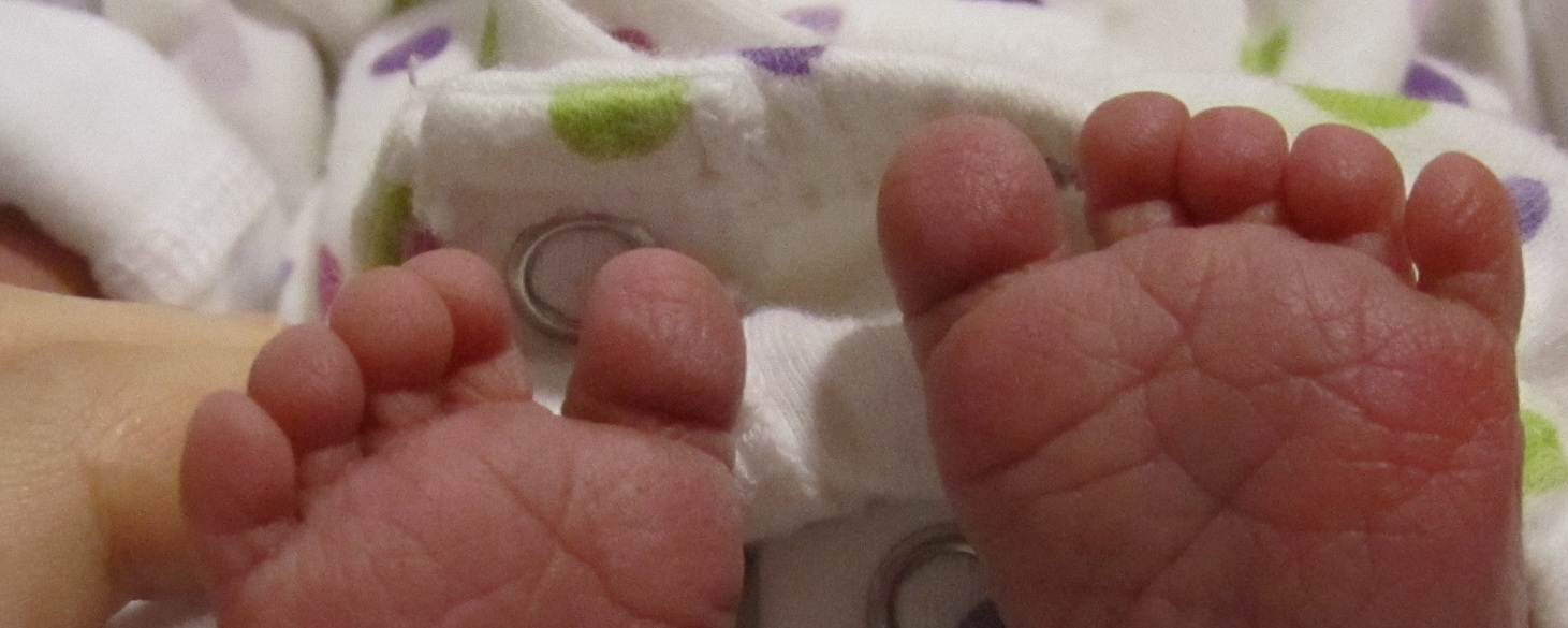 Caribou Fact vs Fiction About How My Child with Down Syndrome Looks