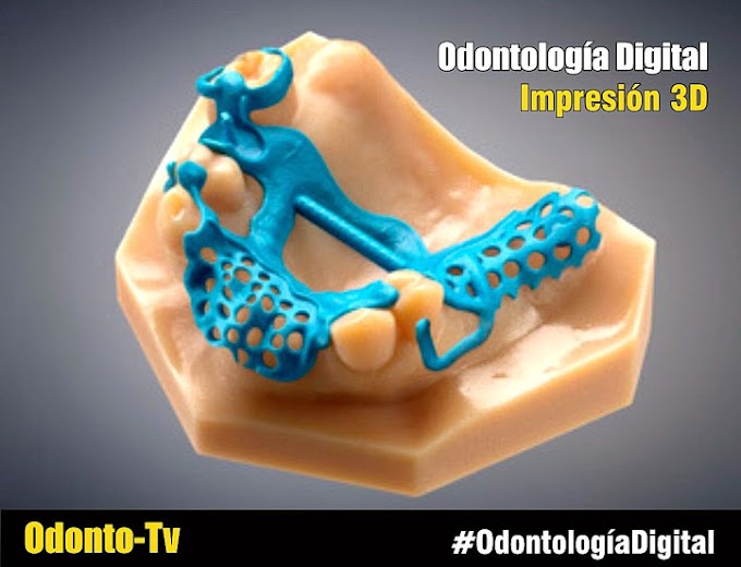 WEBINAR: Introducción a la Odontología Digital para impresión 3D - Dra. Rocío Gutiérrez Ruiz