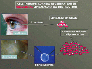cellule staminali limbari