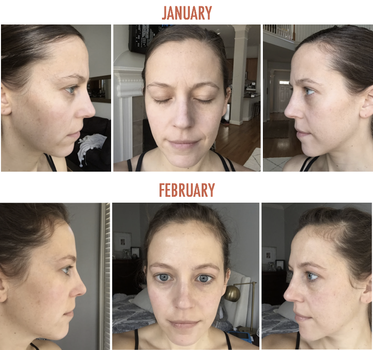 rodan and fields wrinkle cream reviews