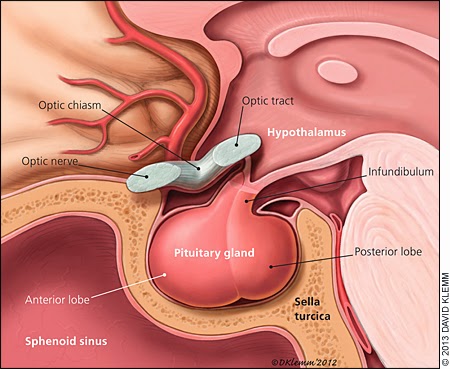 adenom de hipofiza tratament prostatita balanita