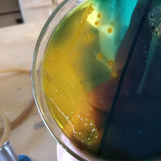 Vibrio on TCBS