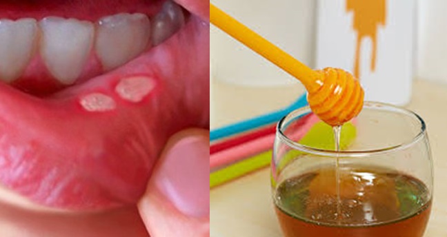 Hasilnya Bikin Takjub!! Hanya Dengan Menyiapkan “Bahan-bahan Dapur” Ini