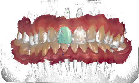 Cad/Cam Technology for the Dental/Orthodontic Specialist: 4Qube, the ...