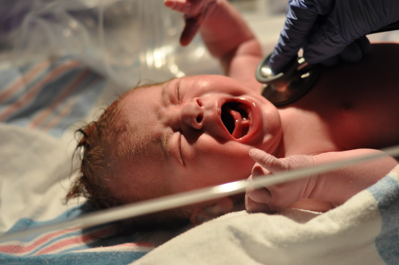 Dealing With a Tongue Tied Infant The Journey of Parenthood...