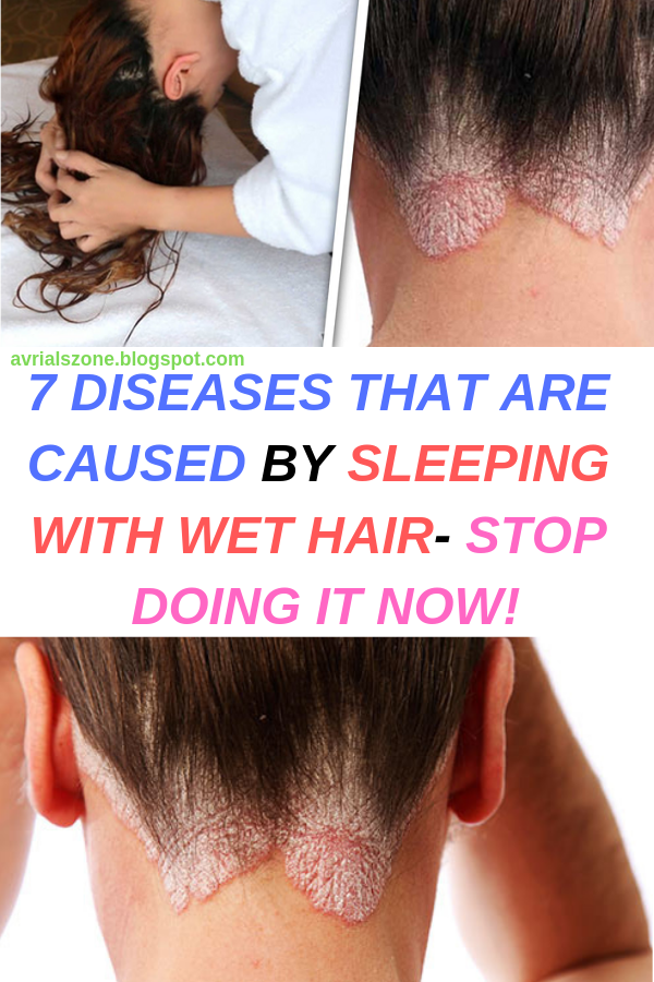 Healthy Beauty and Diet 7 DISEASES THAT ARE CAUSED BY SLEEPING WITH