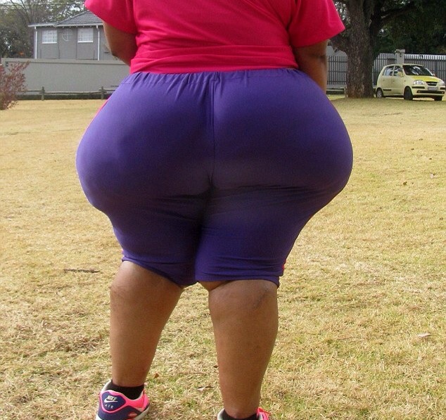 A South African Woman Whose Buttocks Grows Bigger By The -2077