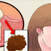 A Treat For Your Teeth; Relieve Toothache Immediately