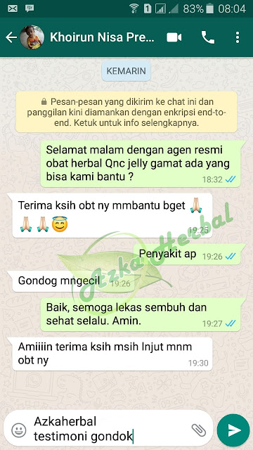 Mengobati Gondok Pada Anak Secara Alami