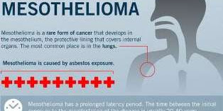 Mesothelioma Cancer Information