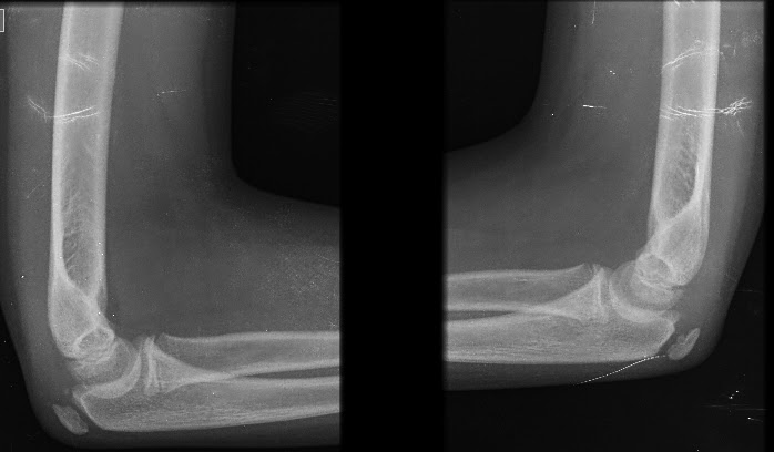 Radiologia: galeria de imagenes