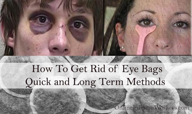 How To Get Rid of Eye Bags: Quick and Long Term Methods