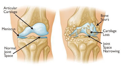 best orthopedic surgeon in Paranaque