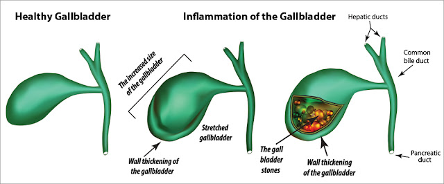 Organ Spotlight: The Gallbladder