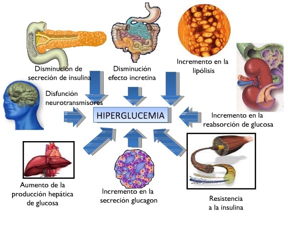 desencadenar pies negros y diabetes desencadenar pies negros y diabetes