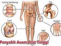 Obat Asam Urat Kumis Kucing