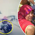 Patah tangan kiri tersepit di rim tayar motosikal