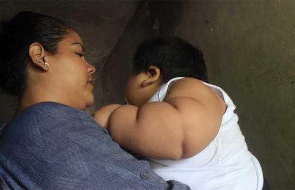 Crece desmesuradamente: tiene 10 meses y pesa 30 kilos Crece desmesuradamente: tiene 10 meses y pesa 30 kilos