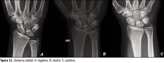 RADIOGRAFÍA DIGITAL, FUNDAMENTOS TÉCNICOS Y ANATOMÍA RADIOLOGICA ...