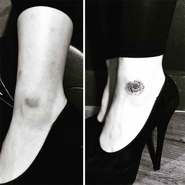 LOOK: Tattoo Artists Create A Masterpiece By Covering Up These Huge Scars With A Stunning Tattoo! LOOK: Tattoo Artists Create A Masterpiece By Covering Up These Huge Scars With A Stunning Tattoo!