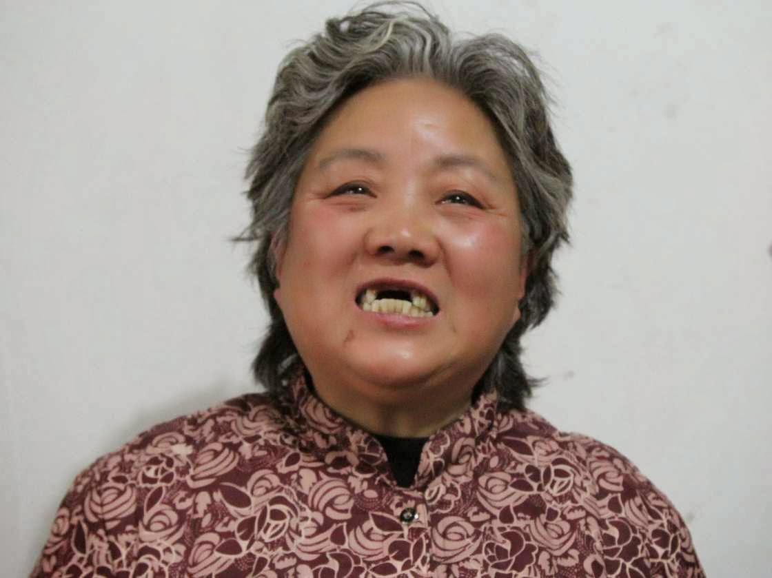 Shen Lixiu, 58, teve arrancados os dentes com socos em 'campo de re-educação pelo trabalho'