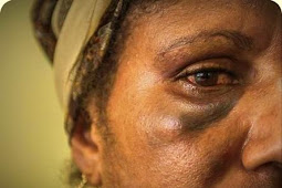 Tingkat Kekerasan Terhadap Perempuan Papua Tertinggi di Indonesia