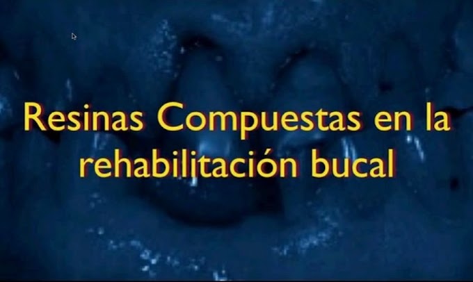 RESINAS COMPUESTAS en la Rehabilitación Bucal al día de HOY - Videoconferencia del Dr. Guillermo Depino