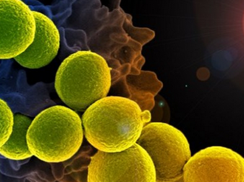 實驗發現脂質體可打敗超級細菌  liposomes can beat superbugs