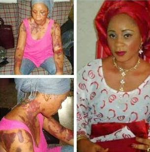 01 See what a man allegedly did to his wife (photo)