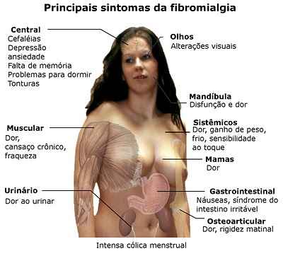 Resultado de imagen de fibromialgia