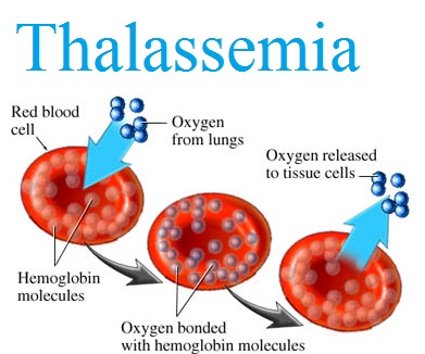 ธาลัสซีเมีย อาการ สาเหตุและการรักษา - ตัวแทนจำหน่าย Lifevantage สอบถามข้อมูลเพิ่มเติม โทร :: 082-236-4928 Line ID :: pla-prapasara