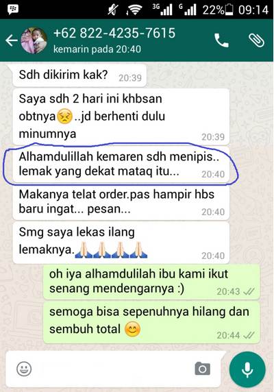 Obat Herbal Mengurangi Mata Minus Silinder Secara Alami - Rekomendasi ...