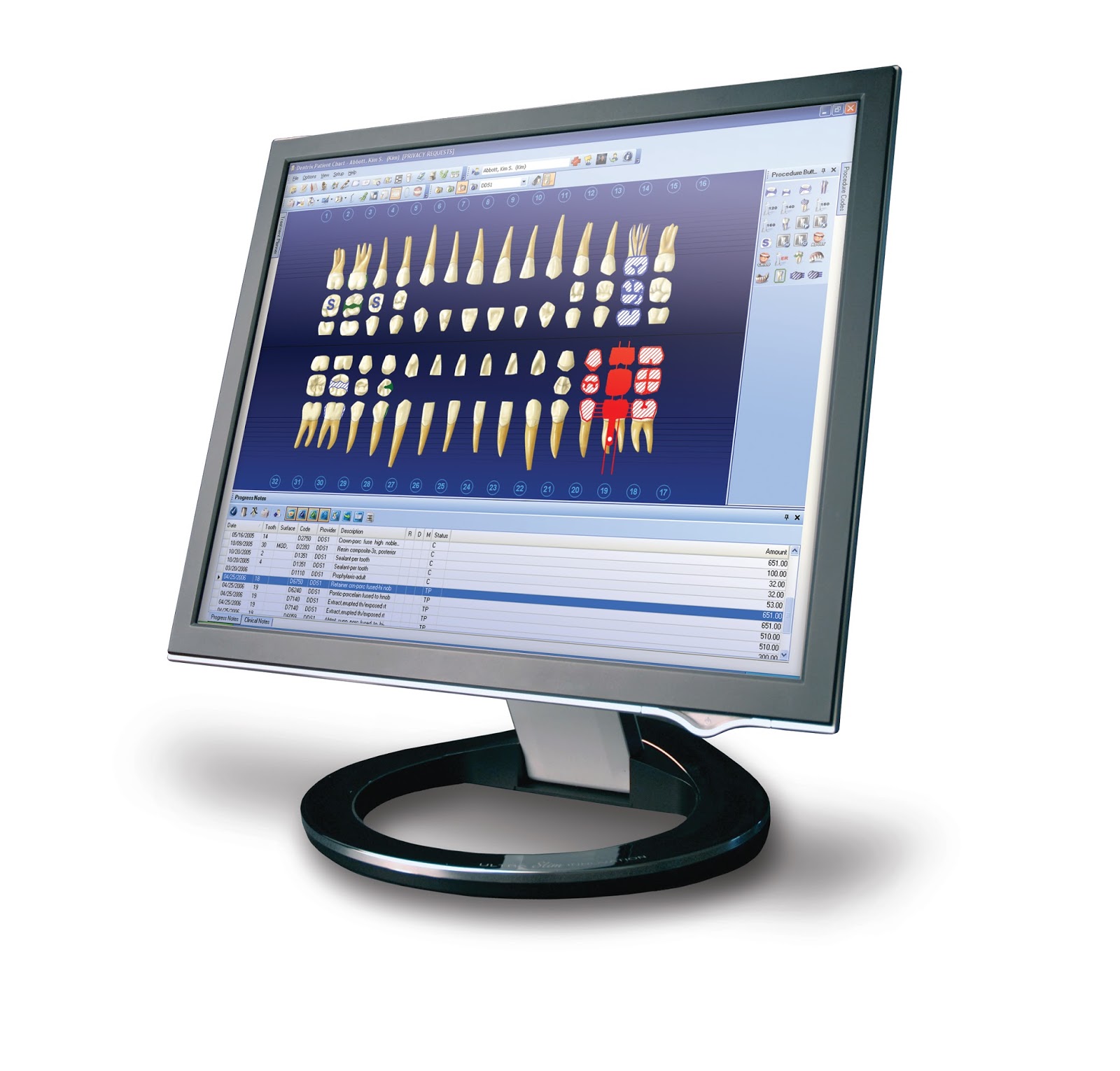 the dentrix office manager blog progress notes vs clinical notes dentrix charting symbols