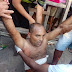 Homem é atingido com 4 disparos de arma de fogo em Bacabal-MA