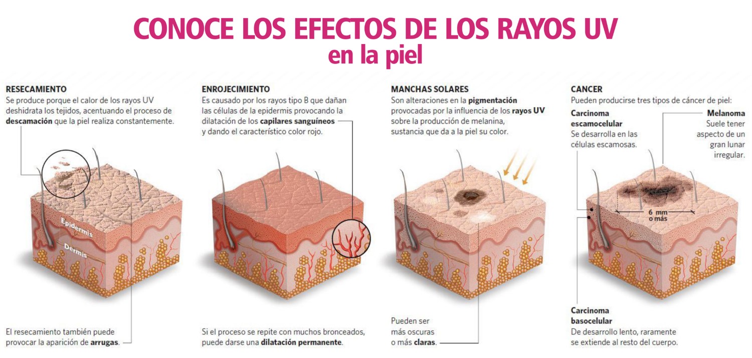 Immunotec Yucatan: Daño a la piel por rayos UV del Sol y protección con