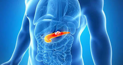 http://gastrosurgeoncochin.com/pancreatic-cancer.html