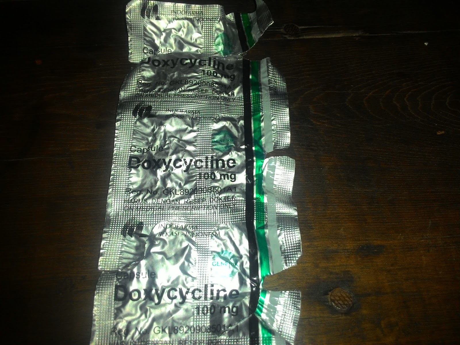 Cara menyembuhkan sakit gigi berlubang paling ampuh - Informasi Obat