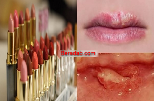 Para Ladies Sebelum Terlambat Stoppppp Menggunakan Lipstik Ini Jika Anda Tidak Akan Seperti Ini!! Ini Daftar Lipstik yang mengandung Timbal yang Sangat Berbahaya